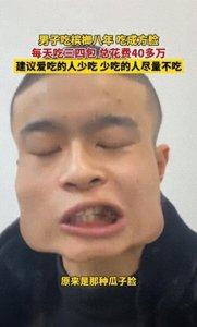 ​长期嚼槟榔的严重后果：8年花费40万，瓜子脸变方块脸