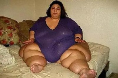 ​世界上最胖的一个人竟然是她!!