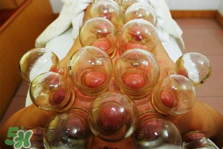 拔罐放血要注意什么？拔罐放血的注意事项