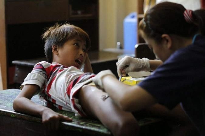 割礼是割什么部位