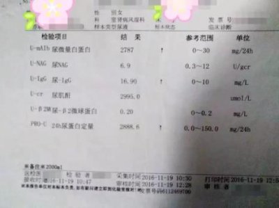 ​白蛋白偏低是什么意思