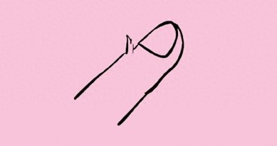 ​「倒刺」为什么一到冬天特别严重？