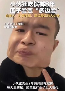 ​河南小伙嚼槟榔8年成方脸：已经吃了40多万，网友：还以为是特效