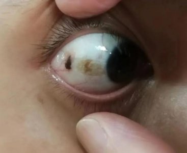 ​相亲时姑娘一句话，小伙越想越怕：我的眼睛好像发霉了