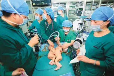 ​1908年，英国臀部连体姐妹出生，姐姐去世器官停止致妹妹一同去世