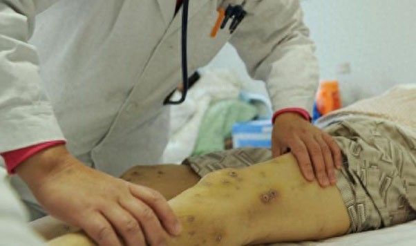 有“中国杀人蜂”之称的胡蜂